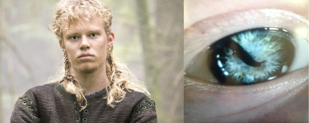 Vikings: What Sigurd's Snake In The Eye Name Means